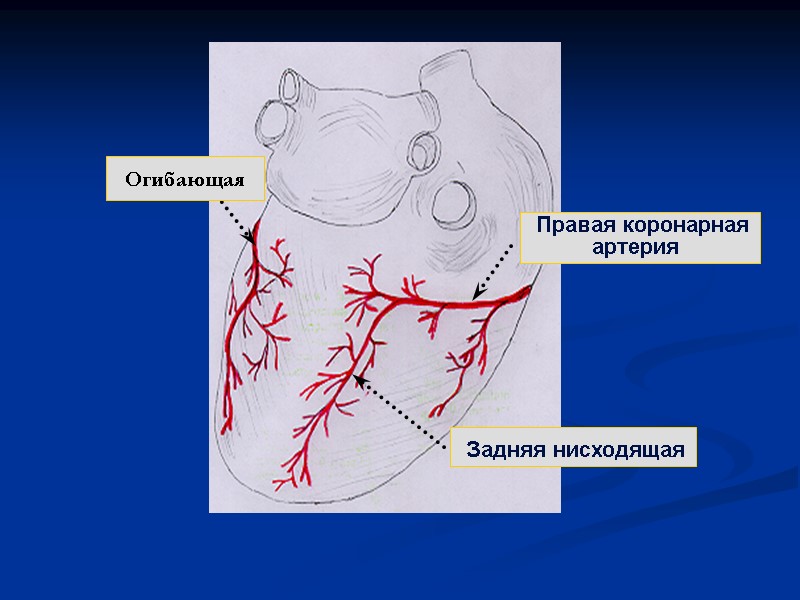 Правая коронарная артерия   Задняя нисходящая  Огибающая